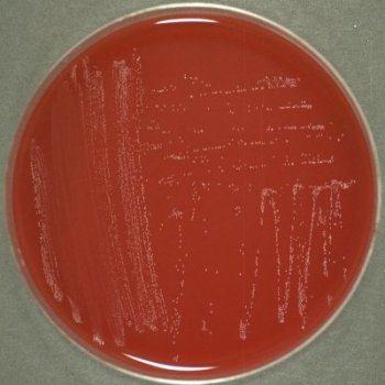 Kingdom: Bacteria Phylum: Firmicutes Class: Bacilli Order: Lactobacillales Lactobacillus rhamnosus Lactobacillus buchneri Lactobacillus johnsonii Assay of Arginin, Folic acid.