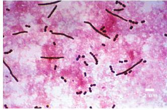 bulgaricus Gram-stained smear from yoghurt showing cells of lactic acidproducing Lactococcus (Streptococcus) lactis and Lactobacillus delbrueckii subsp bulgaricus that will ferment milk to yoghurt.