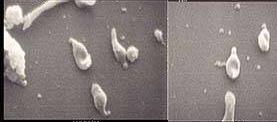It is rod-shaped, Gram-positive aerobes, or facultative anaerobes. Genus: Mycobacterium 297.