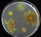 77 305. Kingdom: Bacteria Class: Deltaproteobacteria Order: Myxococcales Myxococcus Xanthus Production of antibiotics.