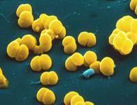 Kingdom: Bacteria Class: Betaproteobacteria Order: Neisseriales Family: Neisseriaceae Genus: Neisseria 315.