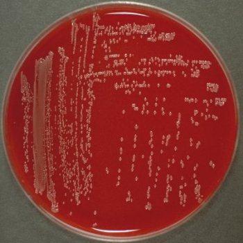 84 Class: Gammaproteobacteria Order: Enterobacteriales Family: Enterobacteriaceae Genus: Proteus 335.