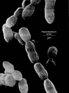 86 342. Kingdom: Bacteria Phylum: Actinobacteria Class: Actinobacteria Order: Actinomycetales Family: Propionibacteriaceae Genus: Propionibacterium 343.