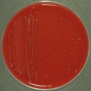 87 347. Kingdom: Bacteria Phylum: Firmicutes Class: Bacilli Order: Bacillales Paenibacillus polymyxa Production of pectic enzymes, pollulanase, Xylanase.