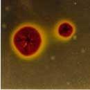 8 7. Domain- Bacteria Phylum- Proteobacteria Class- Gammaproteobacteria Order- Acidithiobacillales Family- Acidithiobacillaceae Genus- Acidithiobacillus Acidothiobacillus ferrooxidans It is