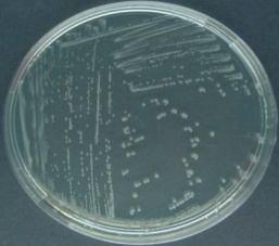 Kingdom: Bacteria Class: Gammaproteobacteria Order: Vibrionales Family: Vibrionaceae Photobacterium phosphoreum Medium sized, semitransparent colonies.