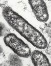 96 Class: Alphaproteobacteria Order: Rickettsiales Family: Rickettsiaceae Genus: Rickettsia or endemic typhus.