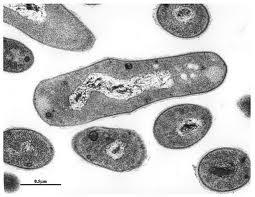 Kingdom: Bacteria Phylum: Actinobacteria Rhodococcus fascians It is a gram positive bacteria cause Leafy gall Class: Actinobacteria Order: Actinomycetales Family: Nocardiaceae