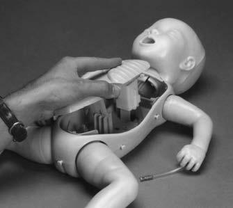 Setup The Life/form Infant ECG/Umbilical Cannulation Skin has been designed to replace the standard outer chest skin on the Resusci Baby* brand CPR Manikins.