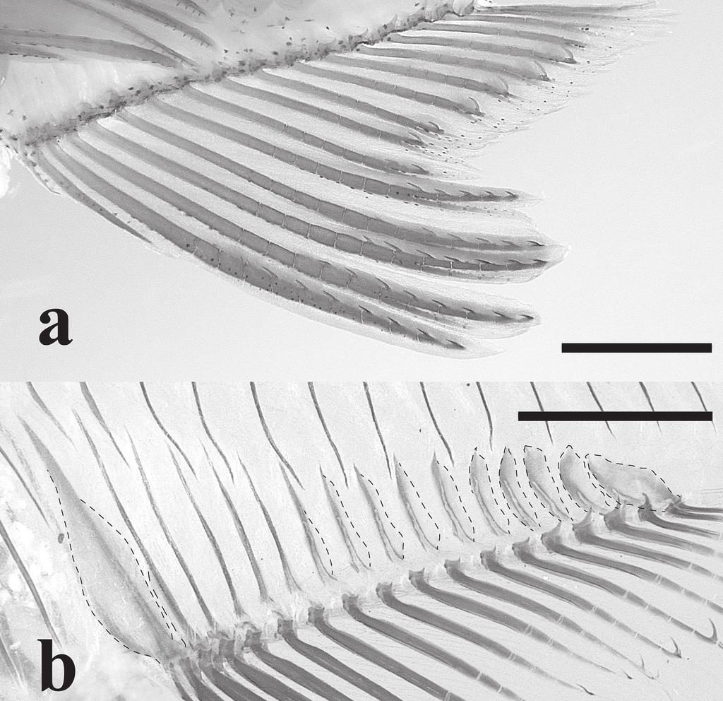 Xenurobrycon varii, anal-fin rays: (a) left side, MPEG 26591, male, 15.0 mm SL, with bilateral, antrorse hooks; (b) right side (inverted), MPEG 26592, male, 13.