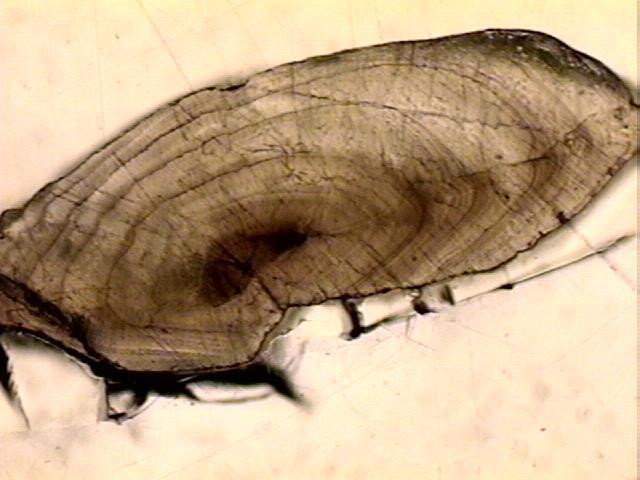 Example of variable growth seen in eel otoliths
