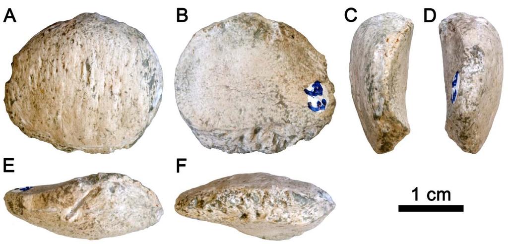 Figure 1. Patella of Pierolapithecus catalaunicus. IPS 21350.37 is shown in anterior (A), posterior (B), lateral (C), medial (D), proximal (E) and distal (F) views. doi:10.1371/journal.pone.0091944.