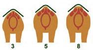 Because of a phenomenon called length of the upper leg to the length of the lower leg will determine 6 schleese.