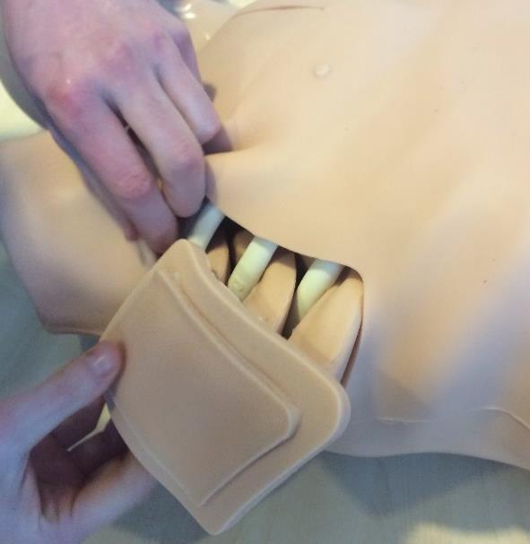 1. To replace the Chest drain replacement tissues, tuck the chest skin out from the insert and remove from the ribs.