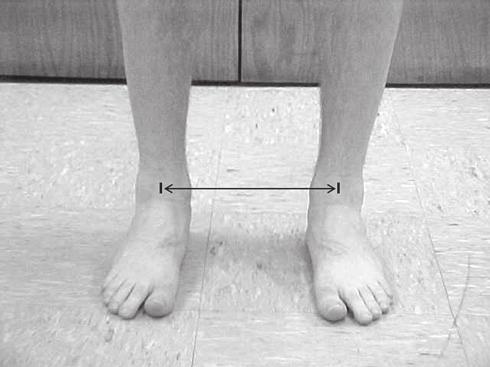 FIGURE 3. Standardized scheme for positioning the distance between the subject s feet.