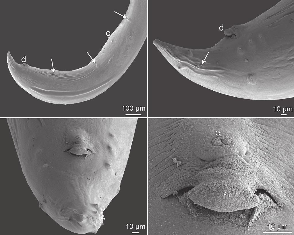 A B C D Fig. 3. Cucullanus epinepheli sp. n., scanning electron micrographs of male from Epinephelus chlorostigma (Valenciennes).