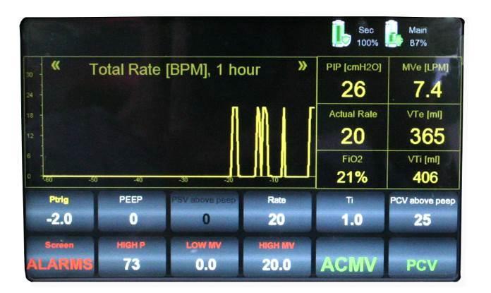 Monitoring 8.1.3 Selecting Trended Parameters The following parameters can be trended: 1. Actual Rate 2. Peak Inspiratory Pressure (PIP) 3.