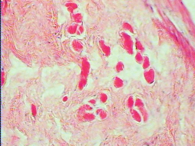 African Catfish Spectum Figure 1: section Septum transversum showing skeletal muscle fibres SK, sandwinched in