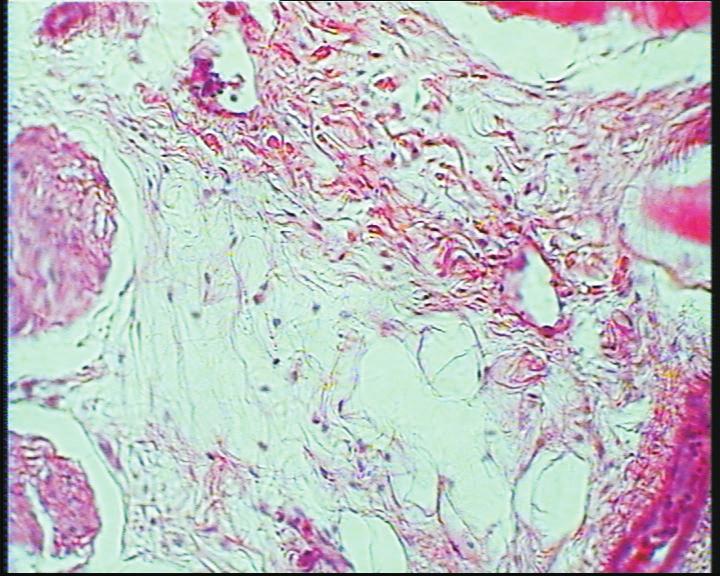 section of Septum transversum showing abundant loose areolar tissue L, containing nerve fibres N, blood