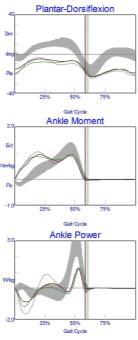 Increased peak ankle dorsiflexion in stance