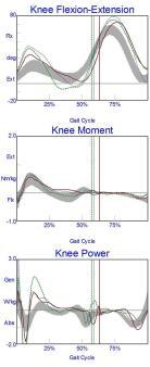flexion in loading with associated knee