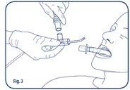 Introduce the BAL catheter by forwarding the catheter through connector B so that the catheter tip protrudes through the connector before connecting to the endotracheal tube Disconnect the