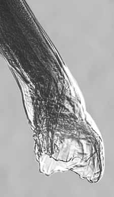 This species has the chicken leg bone look to its walls, but the base of the buccal capsule walls is thin and slanted before the bone appearance starts.