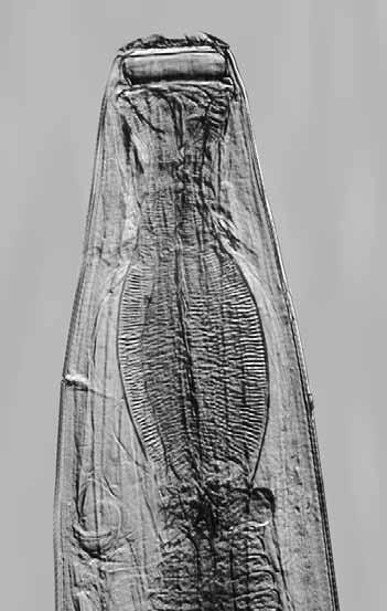 Cylicocyclus elongatus, Cylicocyclus insigne, and Cylicocyclus radiatus 00 µm 00 µm 00 µm Figure a Cylicocyclus elongatus long and straight esophagus Figure b Cylicocyclus insigne pear-shaped