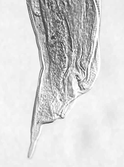 Cylicocyclus leptostomus 30 µm 50 µm 00 µm Figure 5a. straight, thin walls Figure 5b Figure 5c.