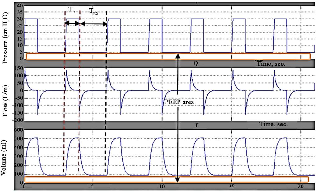 The shown duration equals approximately 21 sec. for 7 complete respiratory cycles. The P, V and F waveforms in this figure remain unchanged in time course.