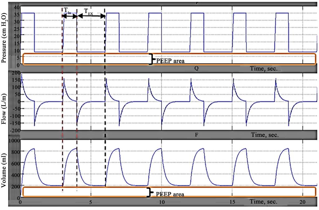 Figure 7. Waveforms of pressure, volume and flow at PEEP = 8 cm H 2 O and IP = 27 cm H 2 O. Figure 8. PV loop of PCV.