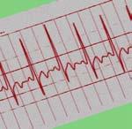 ARTICLE High-frequency oscillatory ventilation a clinical approach Pediatric Critical Care Medicine, Duke University Children s Hospital, Durham, North Carolina, USA Donna S Hamel, RRT, RCP, FAARC