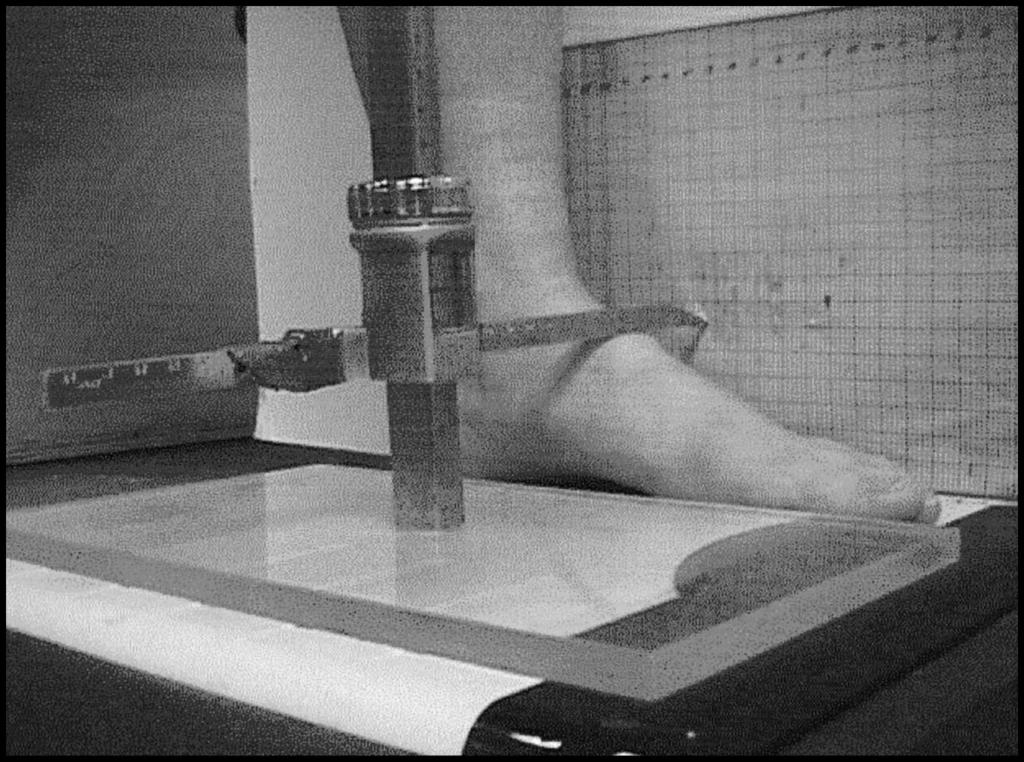 Figure 2. Calipers mounted to Plexiglas plate used to measure the height of the dorsum of the foot.