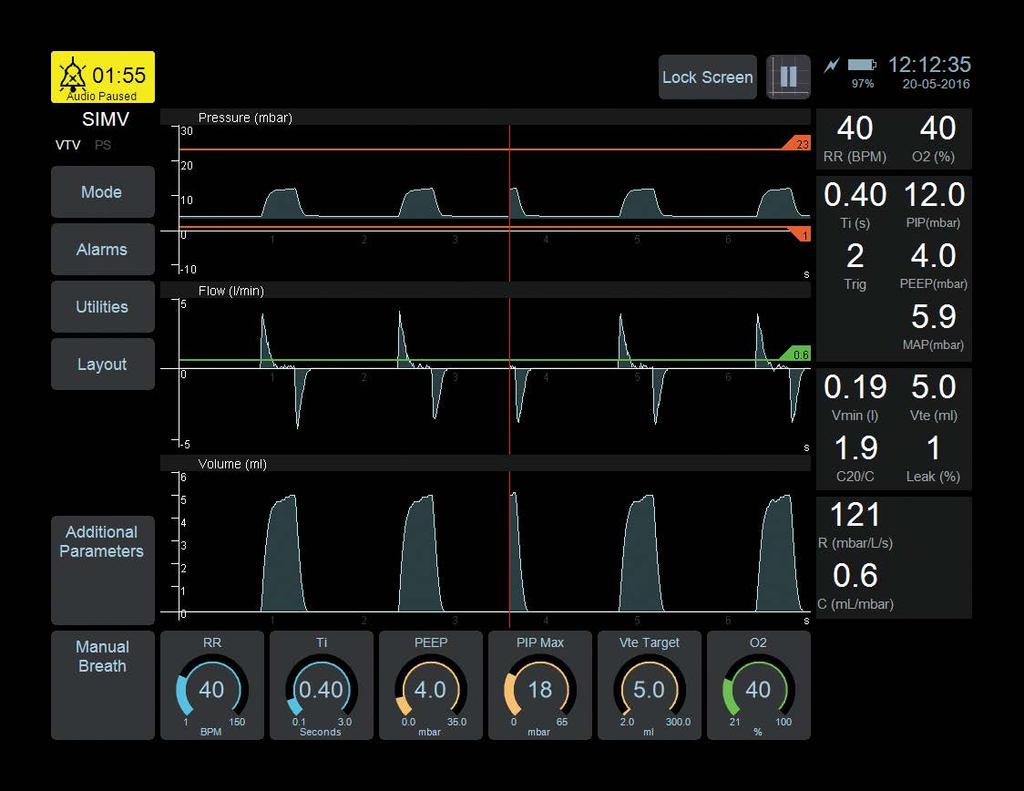 A New Way of Working This ventilator has been set up to show SIMV with three waveforms.