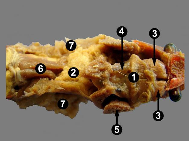 Crayfish internal anatomy Internal anatomy First image (This