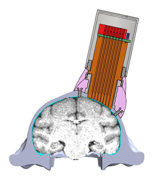 Advancing Electrodes and Recording Neural Activity Figure 25.