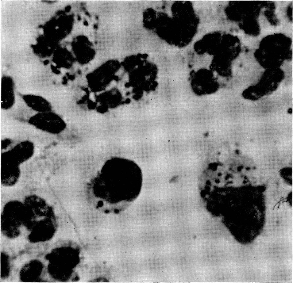 Effects of 4-chlorotestosterone acetate 471 FIG. 1. Morphological aspects of carbon phagocytosis.