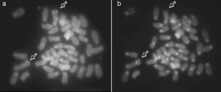 cytogenetic analysis on pterophyllum scalare 141 Fig. 5 a) CMA 3 -banded karyotype of P. scalare.b)sequenced DAPI-banded karyotype of P. scalare.onboth figures the arrows indicate the NOR region.