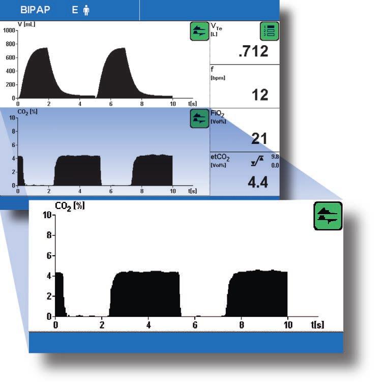 38 39 Capnography Capnography is the measurement and graphical representation of the carbon dioxide partial pressure or carbon dioxide