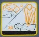 of emergency physician 2 Breaths 30 Compressions UNTIL EMC ARRIVE 30/2 If AED AVAILABLE switch