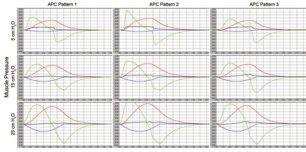 Fig. 4. Representative ventilator waveforms of adaptive pressure control at muscle pressures of 5, 15, and 25 cm H 2 O. Blue line P mus ; black P AW ; green flow; red volume.