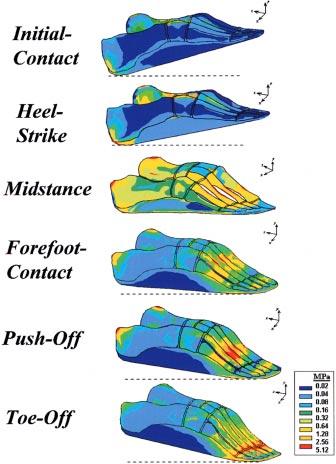 The SIP values obtained from the above-mentioned 36 CPD data sets were compared with the foot model solutions by statistical means, in order to achieve optimal agreement between numerically predicted