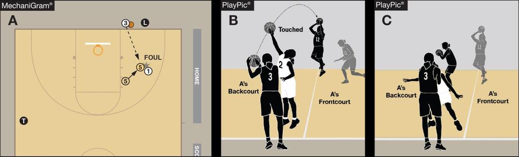Points of Emphasis TEAM CONTROL, THROW-IN When team A fouls during a throw-in (as shown in MechaniGram A), a teamcontrol foul occurs and no free throws result.
