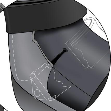 Decreased sensation and/or paralysis oot fractures The shark-o style CRO Orthosis is a viable design that makes fitting and follow-up of the Charcot foot easier and more effective.