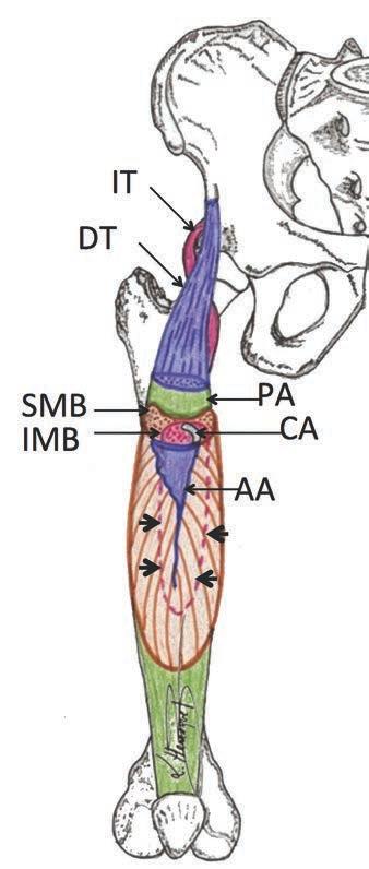 Kassarjian et al. MRI) to determine whether the injuries described involved the intramuscular bipennate portion of the rectus femoris muscle.