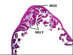 (LMF), fibrous connective tissue (FCT), simple