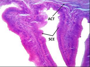 (SMU), mucosal fold (MU F), circular muscle