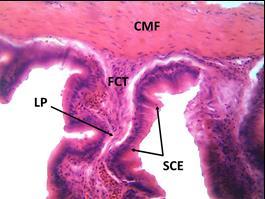 (SMU), mucosal fold (MU F), circular muscle