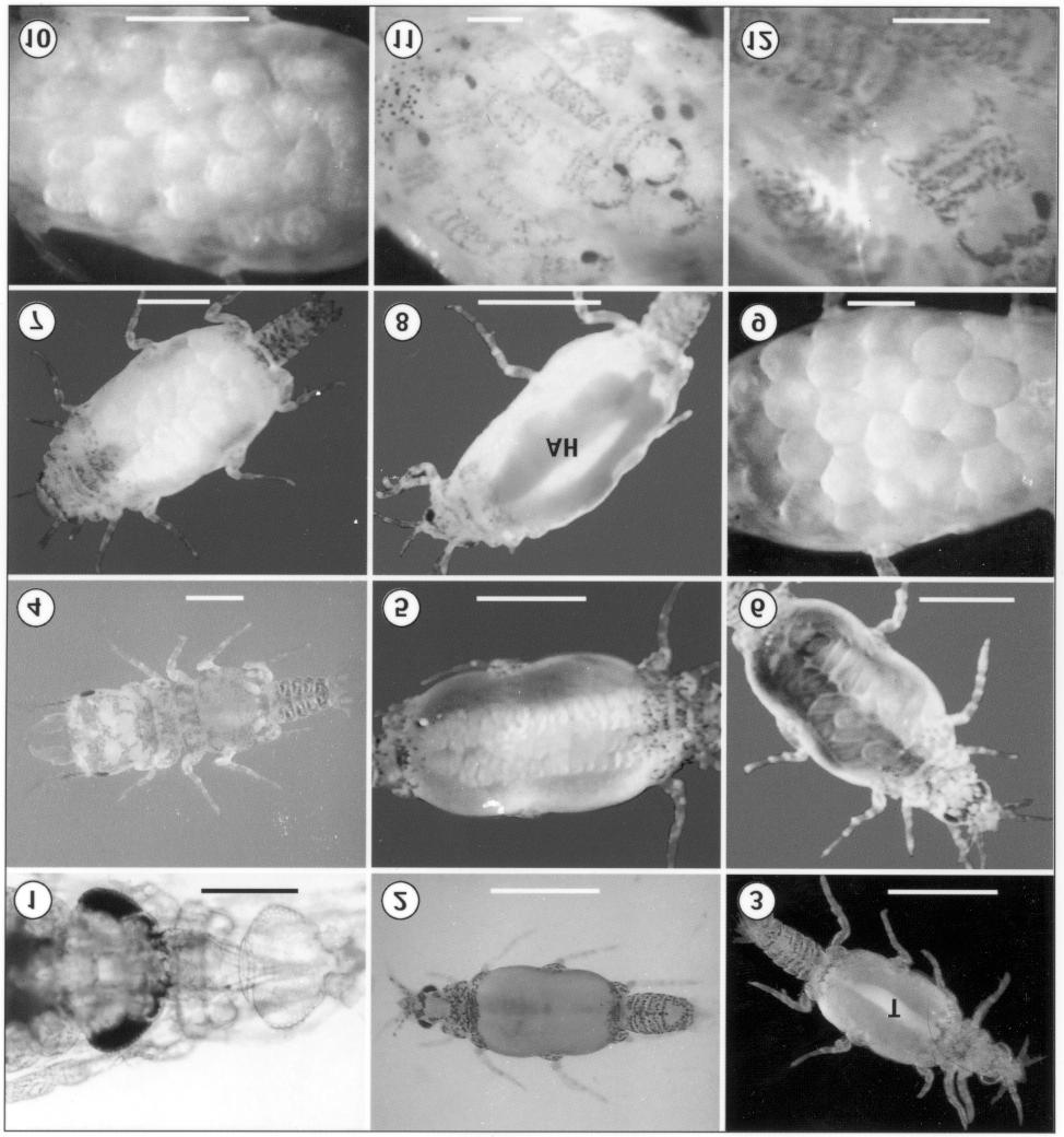 Smit et al.: Life cycle of Gnathia africana Figs. 1 12. Light micrographs of the different developmental stages of Gnathia africana Barnard, 1914. Fig. 1. Praniza 1 during the anterior moult. Fig. 2.