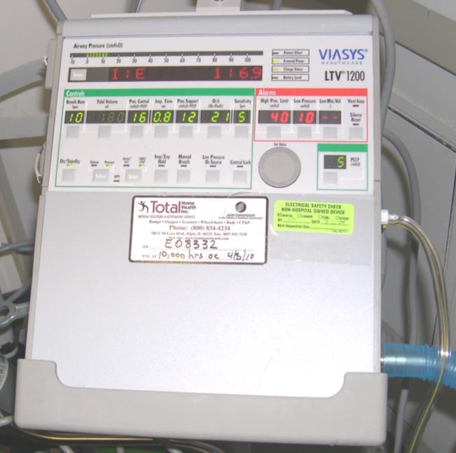 Use of SNS Ventilators in the Pediatric Patient LTV-1200 Quick Set Up Preuse Vent Op/Leak test/new Patient/Patient Size Mode SIMV, Assist Control (A/C), Pressure Support-CPAP, NPPV Volume 10 ml/kg